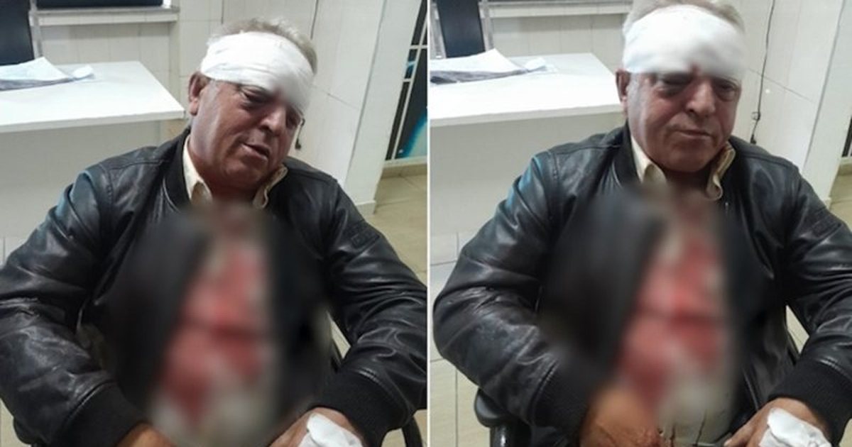 E rëndë! Dhunohet barbarisht punonjësi i pastrimit në Vlorë