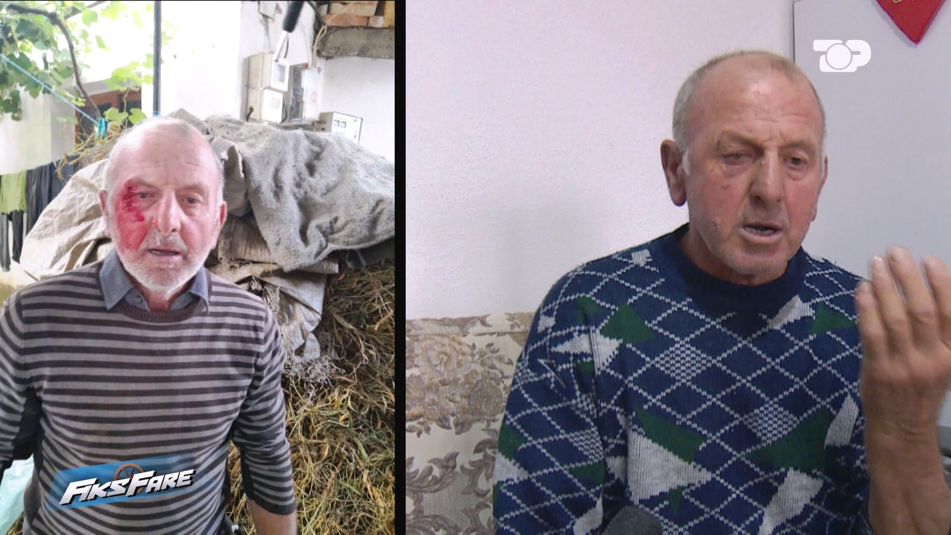 Fiks Fare/ Dhunohet familja në Devoll, policia lë të lirë autorin. Mjeku ligjor vonon ekspertimin