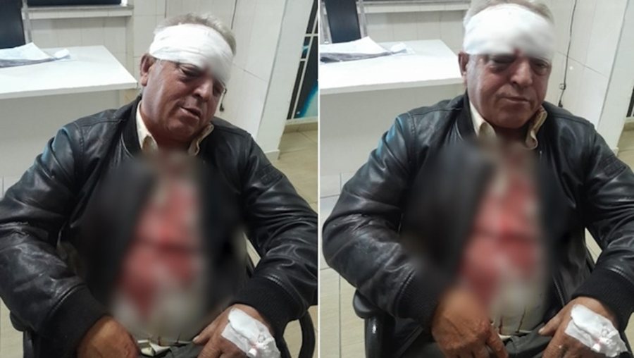 “Goditi furgonin me biçikletë”/ Zbardhet dëshmia e dy autorëve që dhunuan punonjësin e pastrimit