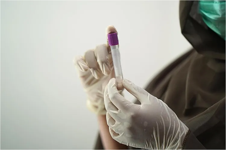 Grupi i gjakut dhe lidhja e tij me rrezikun e goditjes në tru: çfarë zbulon një studim i ri gjenetik