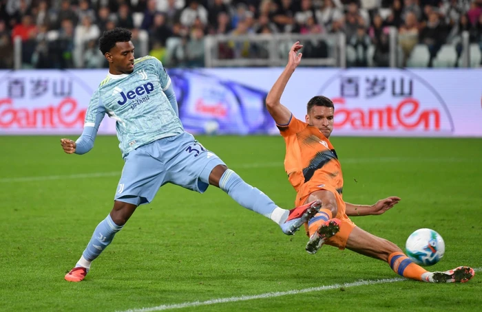 Juventusi merr një lajm të keq pas Champions-it, lojtari dëmtohet dhe mungon 2 muaj