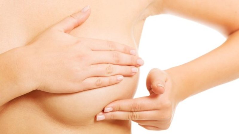 Mos u panikosni, gungat e forta në gjinj jo gjithmonë janë kanceroze. Ja çfarë mund t’i shkaktojë