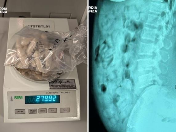 Nga tregtare veshjesh në trafikante! Çfarë i gjetën në stomak 46-vjeçares në aeroportin e Italisë