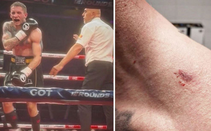 Njësoj si Tayson, shqiptari kafshon serbin dhe fiton ndeshjen e boksit