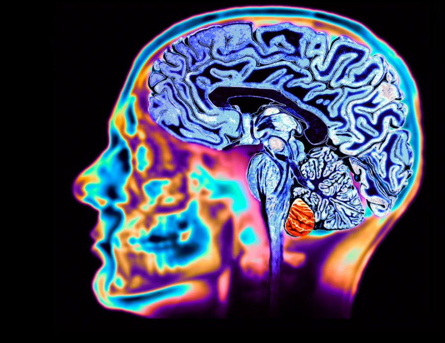 Roli misterioz i litiumit në tru dhe parandalimi i Alzheimerit