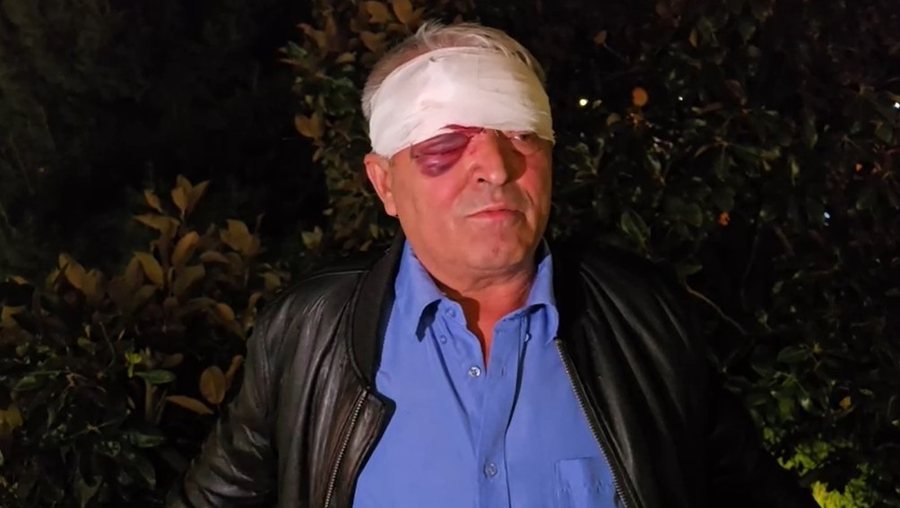 “S’i kam borxh as 100 lekë askujt”, qytetari: Më dhunuan dy djem të rinj pa asnjë arsye