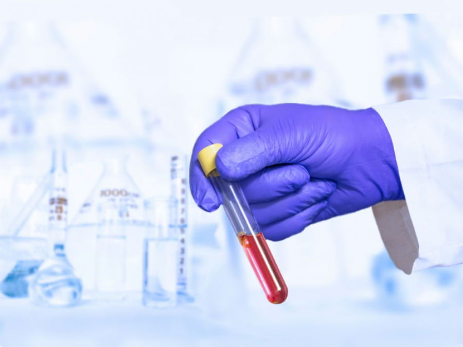 Test revolucionar i gjakut që zbulon kancerin në fazë të hershme, premton ndryshim rrënjësor në diagnostikim