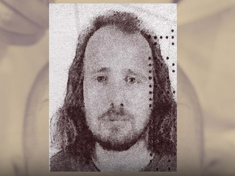 EMRI / Shkoi që të mbillte flokët në Turqi, vdes pas transplantit shqiptari