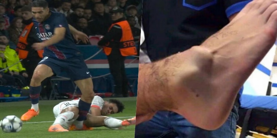 Hakimi, pamje tronditëse e kyçit të këmbës pas ndërhyrjes brutale të Luis Díaz