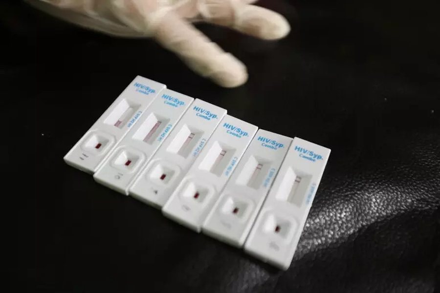 OBSH jep alarmin: Gjysma e diagnozave të HIV në Europë zbulohen shumë vonë