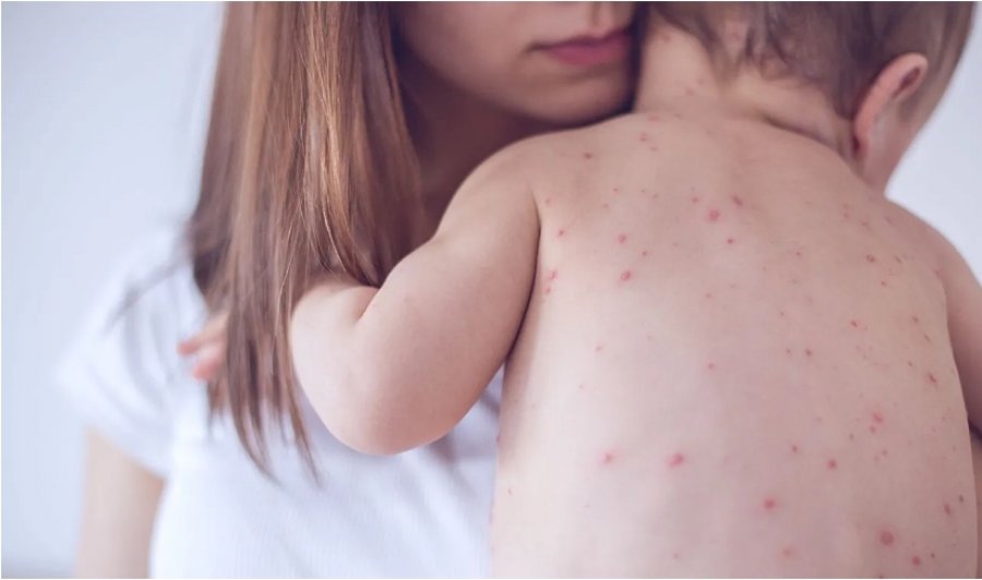 OBSH: Rastet e fruthit u rritën me 47% në Evropë dhe Azinë Qendrore vitin e kaluar, ja shkaqet