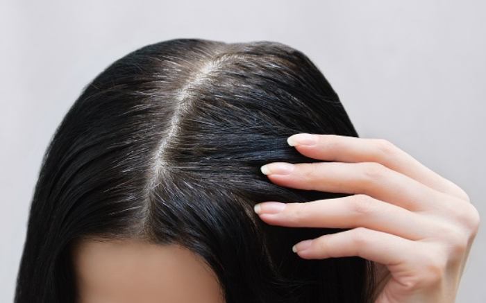 Pse disave u dalin thinjat në moshë të re?