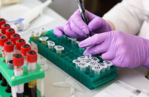 Shkencëtarët identifikojnë shkakun e sëmundjes autoimune Lupus, ndodh kur…