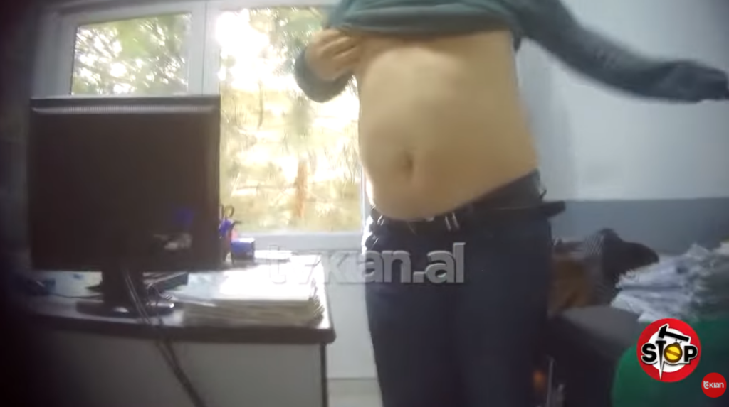 VIDEO-“Prekje e propozime seksiste pas vizitave”/ Ngacmoi seksualisht pacienten, arrestohet mjeku në Tiranë