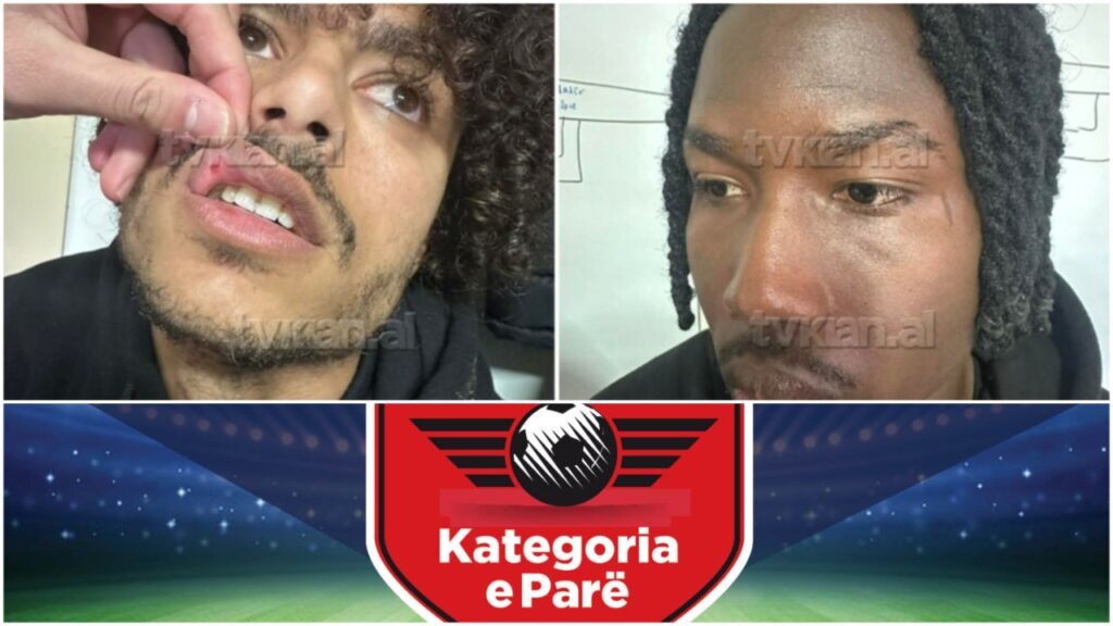 Dhuna ndaj Skënderbeut, Disiplina dënon Ilirinë. Zbulohen vendimet