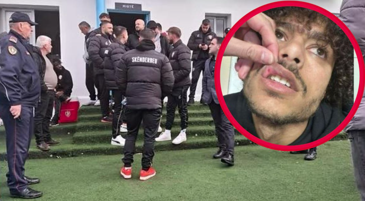 Dhunuan kundërshtarët para ndeshjes në Fushë Krujë, nën hetim tre futbollistët e skuadrës “Iliria”