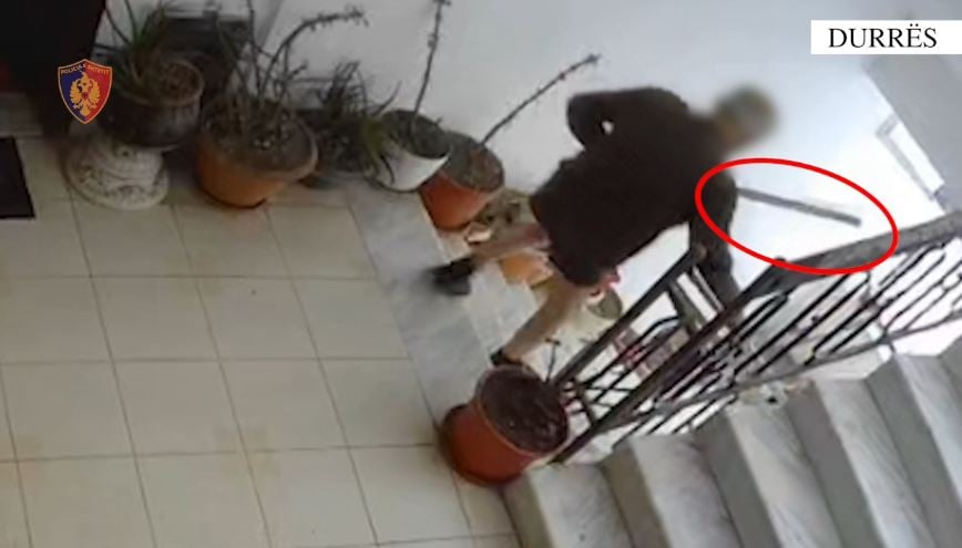 E rëndë në Durrës/ I moshuari tenton të vrasë gruan duke e goditur me sende të forta në kokë, 70-vjeçarja dërgohet te Trauma