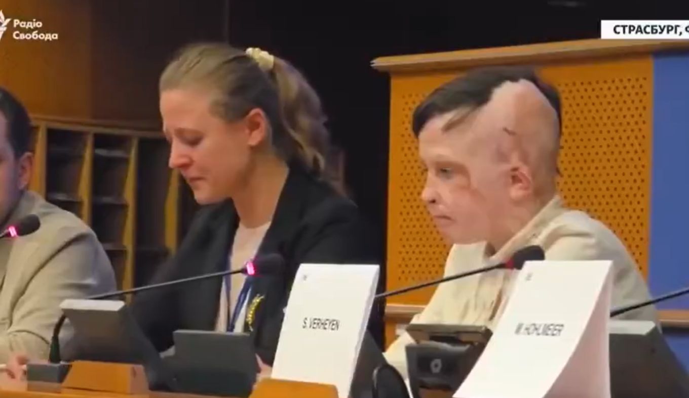 “Ishte hera e fundit që pashë mamin tim”, fjalimi që përloti Strasburgun, 11-vjeçari nga Ukraina tregon si humbi nënën nga bombardimet ruse