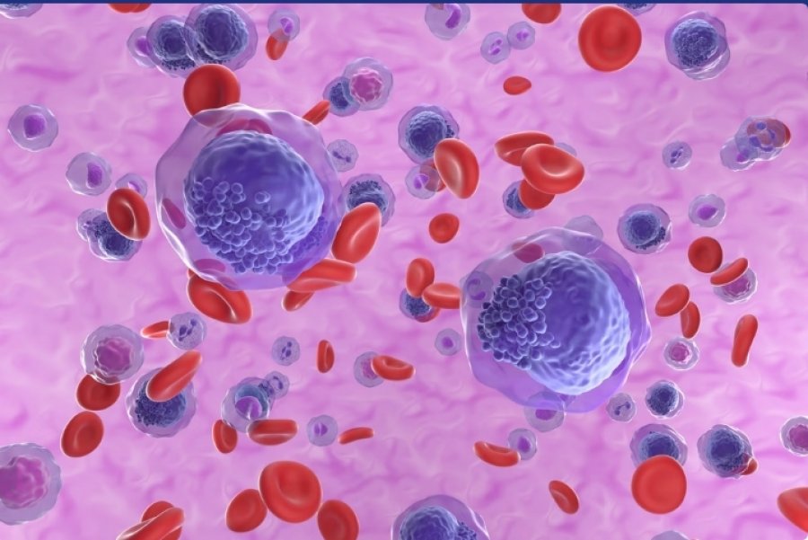 Një trajtim i ri pionerues përmbys kancerin e pashërueshëm të gjakut tek disa pacientë