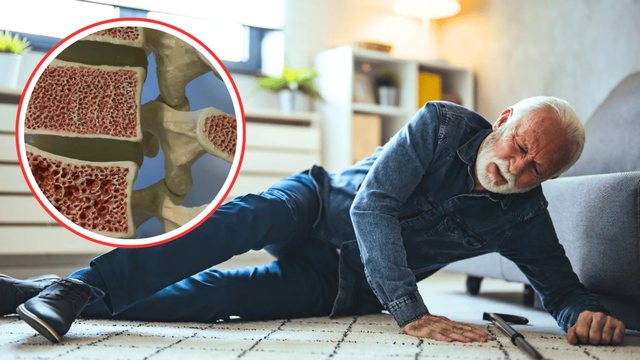 Sëmundjet e kockave! Si t’i dalloni dhe si t’i parandaloni