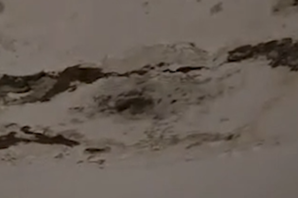 Skandal në Maternitetin e Lushjes, muret dhe tavanet i mbulon myku dhe lagështia