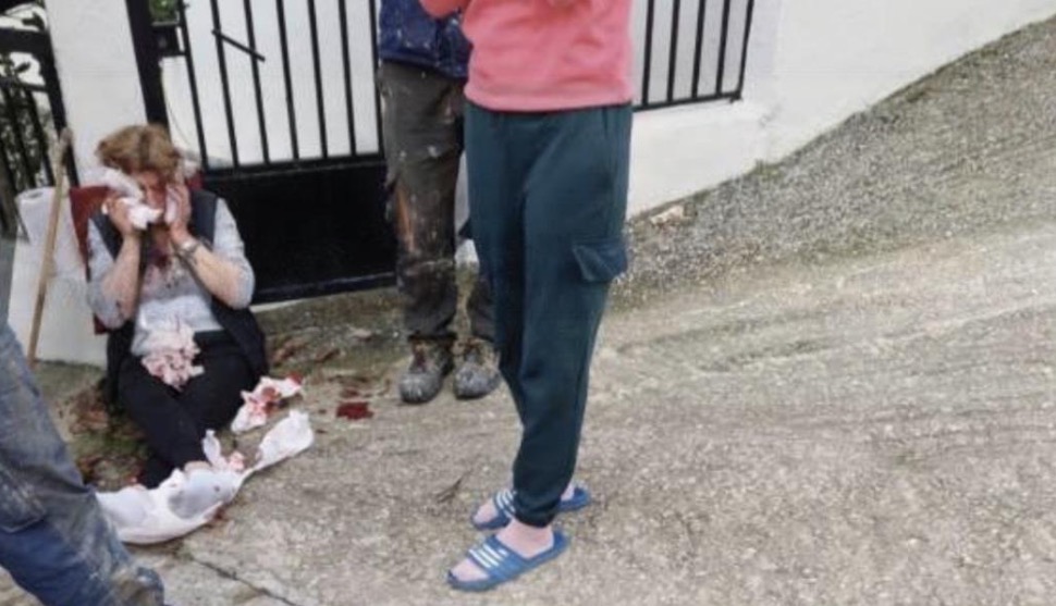 VIDEO/ ‘Bëra atë që doja’, shqiptari masakron me thikë ish-gruan, 50-vjeçarja humb një pjesë të…