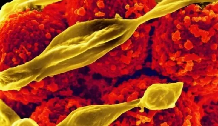 Rezistenca e shumë patogjenëve ndaj antibiotikëve/ Paralajmërohen miliona vdekje deri në vitin 2050