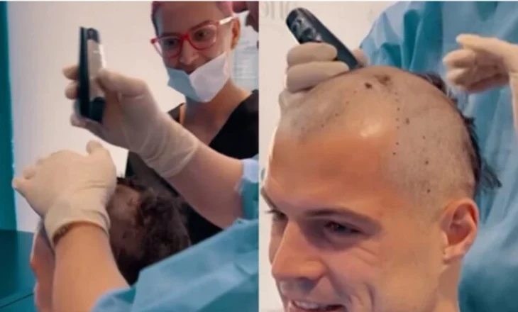 Granit Xhaka ndryshon look, mesfushori shqiptar kryen transplantin e flokëve (Video)