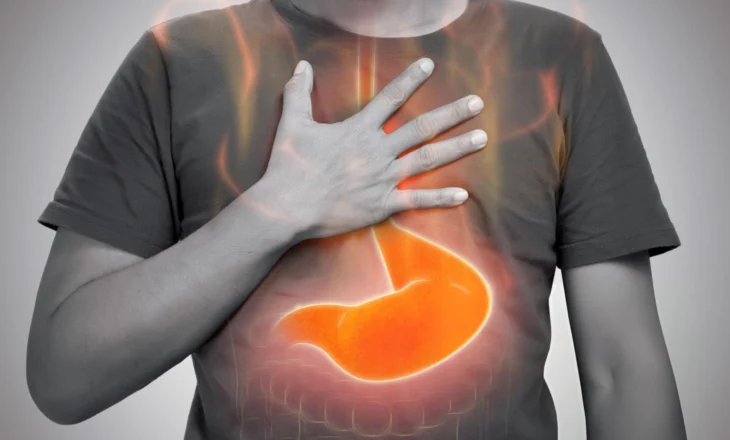 Refluksi Gastroezofageal – Çfarë Duhet të Dini Për Djegien e Stomakut