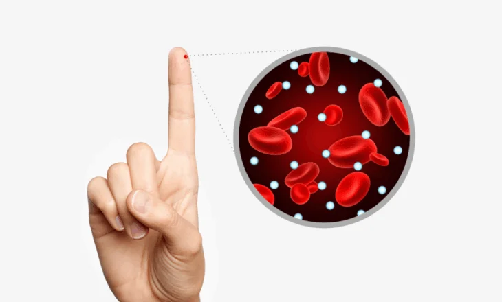 Rezistenca ndaj insulinës tek të rinjtë ndihmon në parandalimin e diabetit të tipit 2