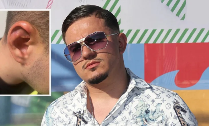 Rrëmbehet dhe torturohet djali i biznesmenit grek, autorët kërkuan 25 mijë për ta lënë të lirë