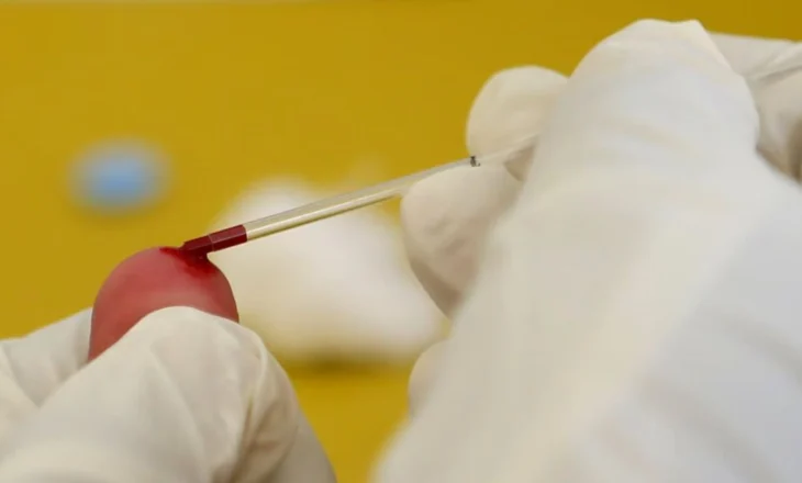 HIV në rritje: 10 raste të reja në pesë muaj