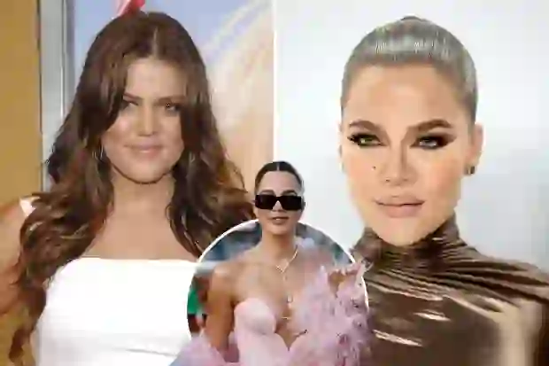 Khloe Kardashian zbulon të gjitha operacionet plastike që ka kryer