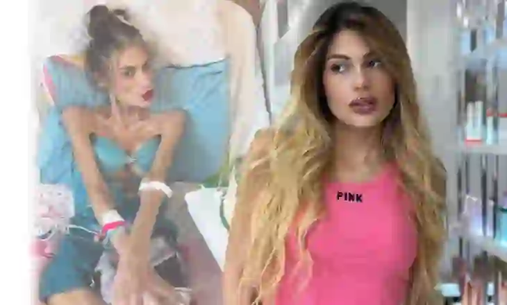 Kush ishte Nihal Candan? Gjithçka rreth influencueses turke që ndërroi jetë nga anoreksia