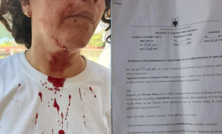 Përplasje për hapësirën e plazhit në Radhimë, dy persona përfundojnë në spital nga dhuna