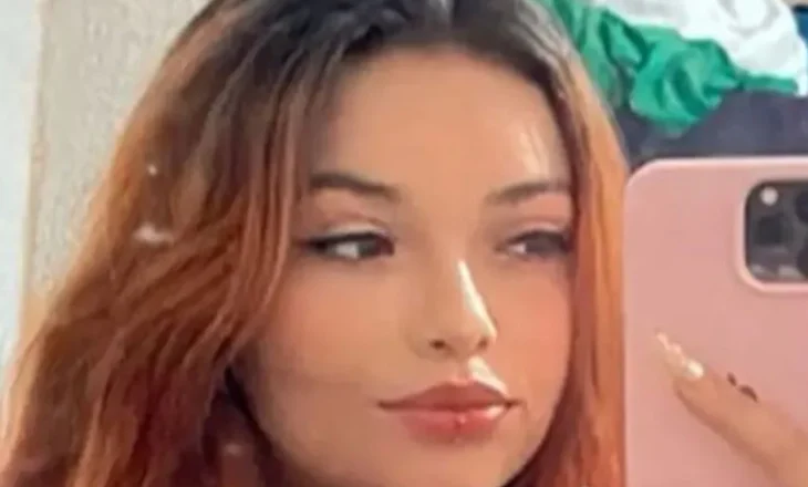 Vdekja e tmerrshme! 24-vjeçarja bie në xhakuzi dhe digjet, ndërron jetë pas 6 ditësh në spital
