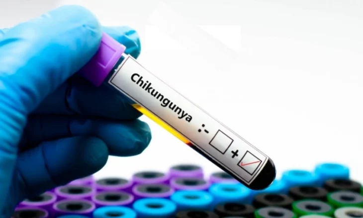 Chikungunya, alarm në Europë/ Epidemi në Francë dhe rast i parë i konfirmuar në Itali, OBSH paralajmëron rrezik global