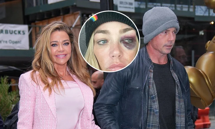 Denise Richards merr urdhër mbrojtjeje ndaj bashkëshortit: Më ka goditur dhe më ka zënë për fyti