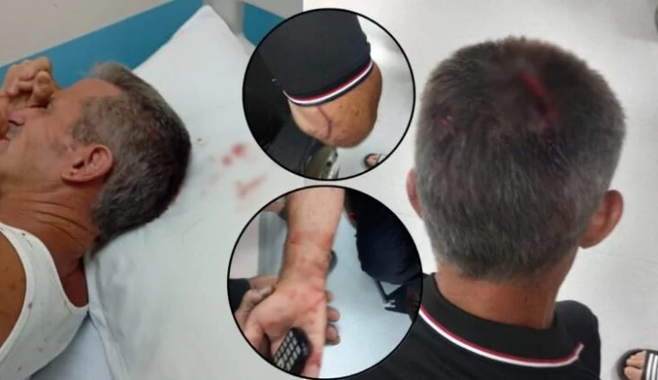Denoncimi me FOTO/ Përfaqësuesit e “Shpërdhaza-Energji” që do ndërtojë HEC-et në Kaçinar dhunojnë brutalisht banorin e zonës