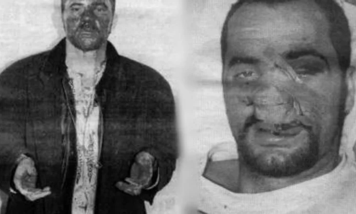 “Dhuna ishte brutale”, Rama flet në “ZEITmagazin” për episodin e rëndë në ’97: Më lanë të mbuluar me gjak, menduan se kisha vdekur