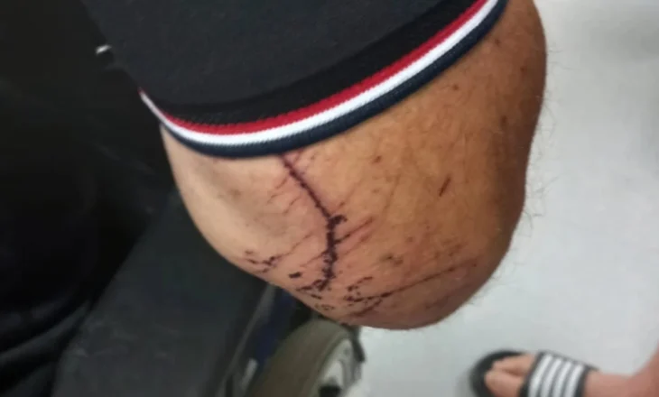Dhunimi i banorit në Mirditë, policia: Kishte plagë në trup dhe kokë, shoqërohet në polici autori i dyshuar