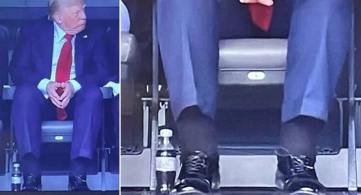 Fotot e bëra virale, Shtëpia e Bardhë: Trump vuan nga pamjaftueshmëria venoze kronike