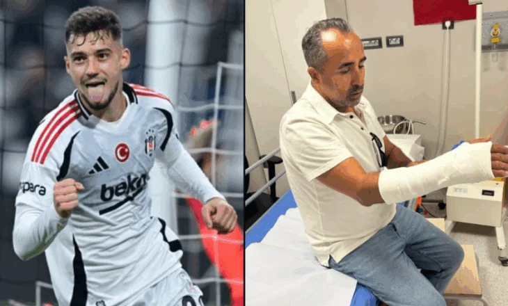 Incidenti i paprecedentë. Goditja e Muçit bën për spital fotografin në Turqi, 2 fraktura dhe 1 çarje