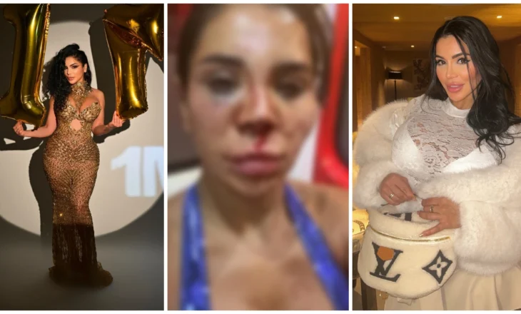 Influencerja e njohur përjeton tmerr, hajdutët i hyjnë në shtëpi dhe e rrahin brutalisht, dyshohet për abuzim seksual