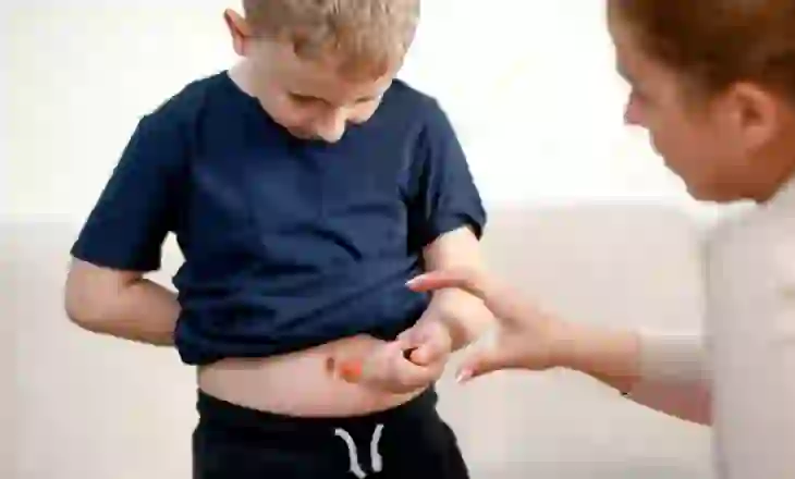 Konsumimi i tepërt i mishit të kuq dhe ushqimeve të tjera inflamatore gjatë shtatzënisë, rrit rrezikun e diabetit tek fëmijët
