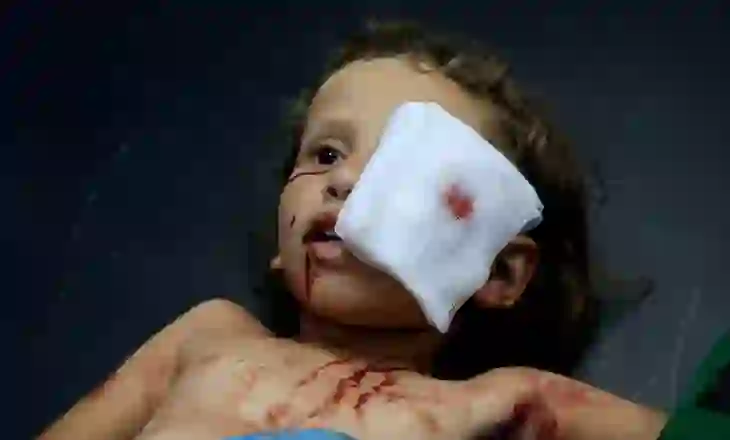 Po përgatitesha për të shëruar sytë në Gaza. Pastaj gjithçka u errësua!