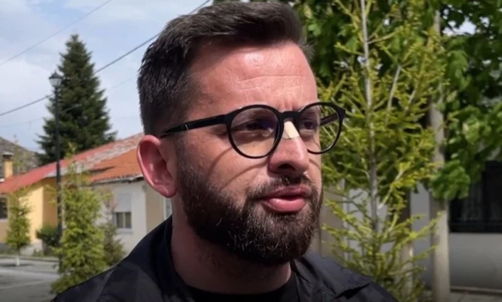Rama shembi bujtinat në Theth/ Edhe “Çuçka” i Kolonjës nuk mbetet pas, i sulet stallës së fermerit