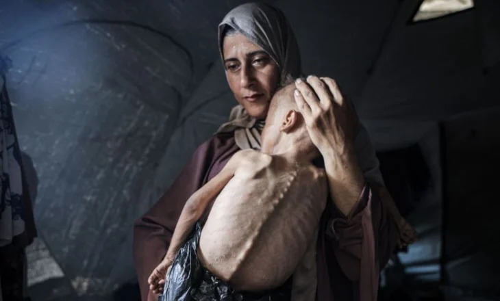 Spitalet e Gazës janë “ferr në Tokë”/ Mjekëve dhe infermierëve u bie të fikët nga uria