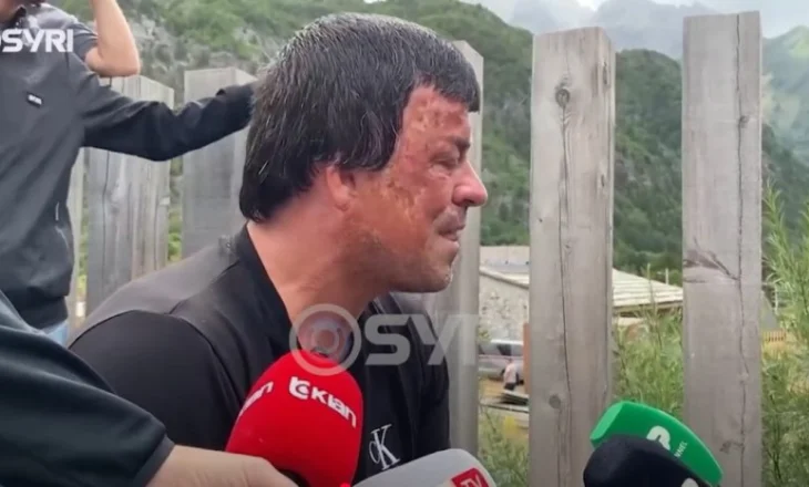SYRI TV/ Banorët e Thethit përplasen me policinë, dhuna policore s’kursen gratë e të moshuarit