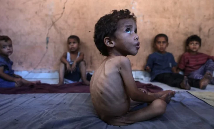 “Amnesty International” akuza Izraelit: Po aplikon një politikë të qëllimshme për të shkaktuar uri në Gazë!
